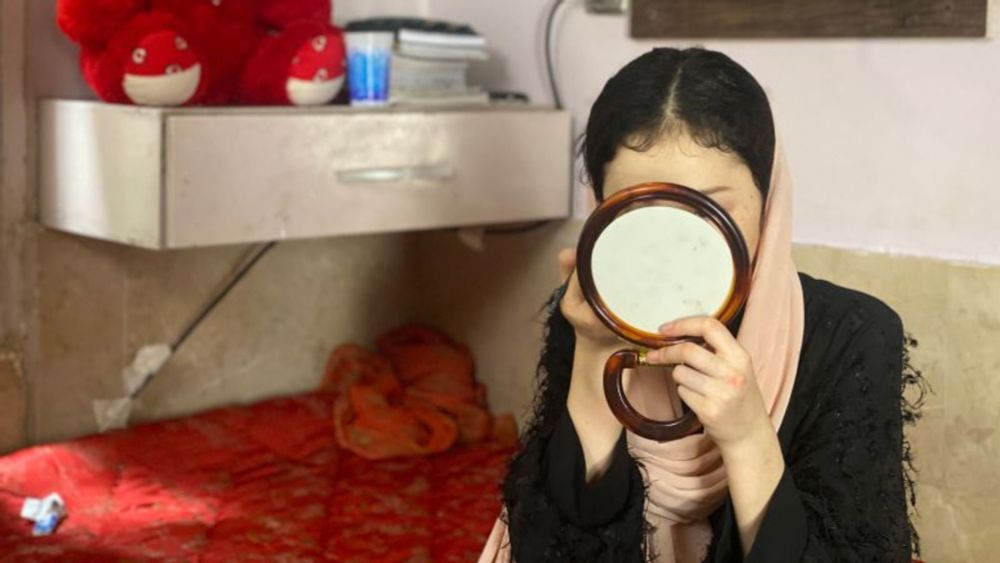 A year ago, she drank battery acid to escape life under the Taliban. Today, she has a message for other Afghan girls | CNN