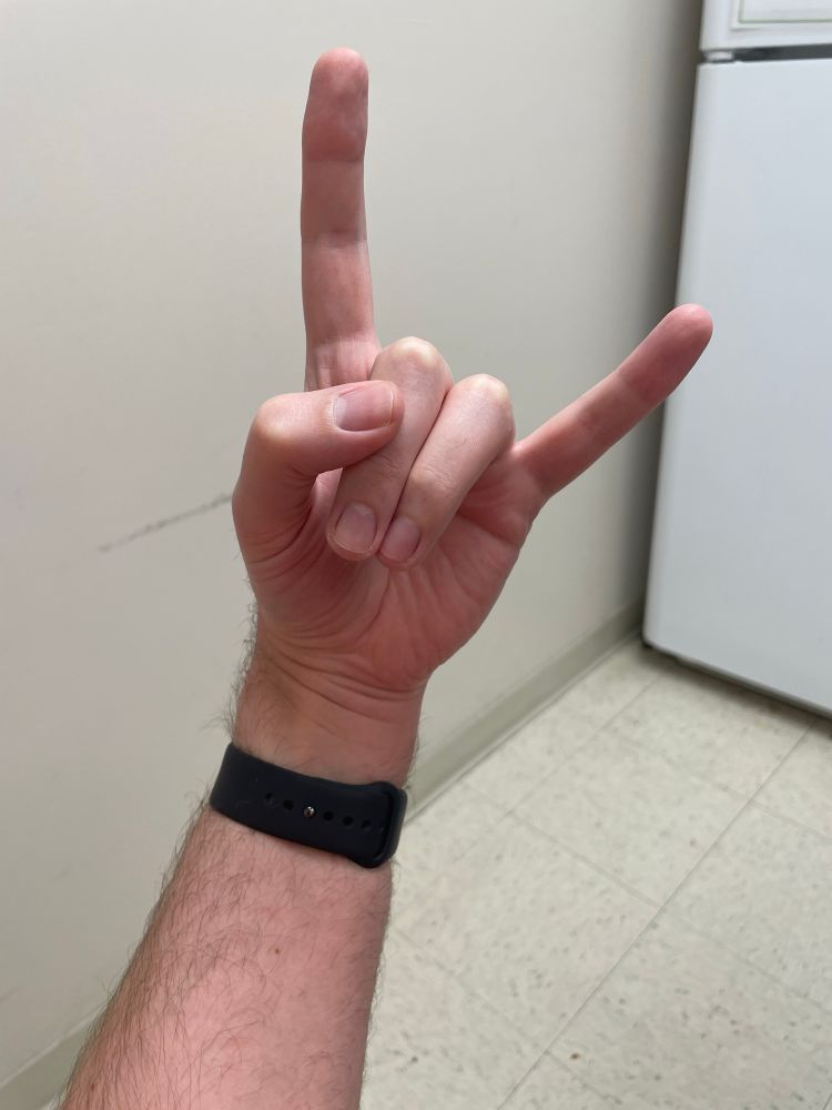 See? That’s technically skin. What did you *think* you were going to see here? Get your mind out of the gutter, you sloptarts! (Alternatively, come sit next to me in aforementioned gutter)

Also: rock on! 🤘 