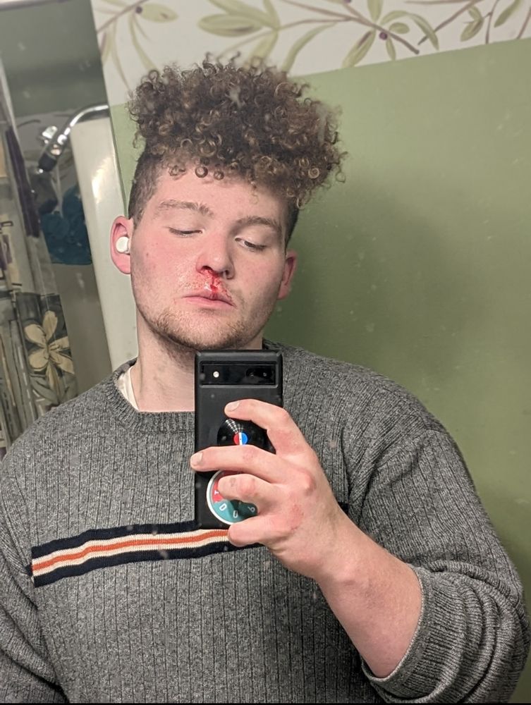 Steven from a darker year in his life 
