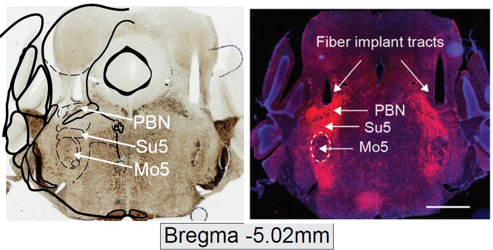 Coronal section of mouse pons showing central amygdala axons in the parabrachial and supratrigeminal areas. It also show the optic fiber implants above these axons.