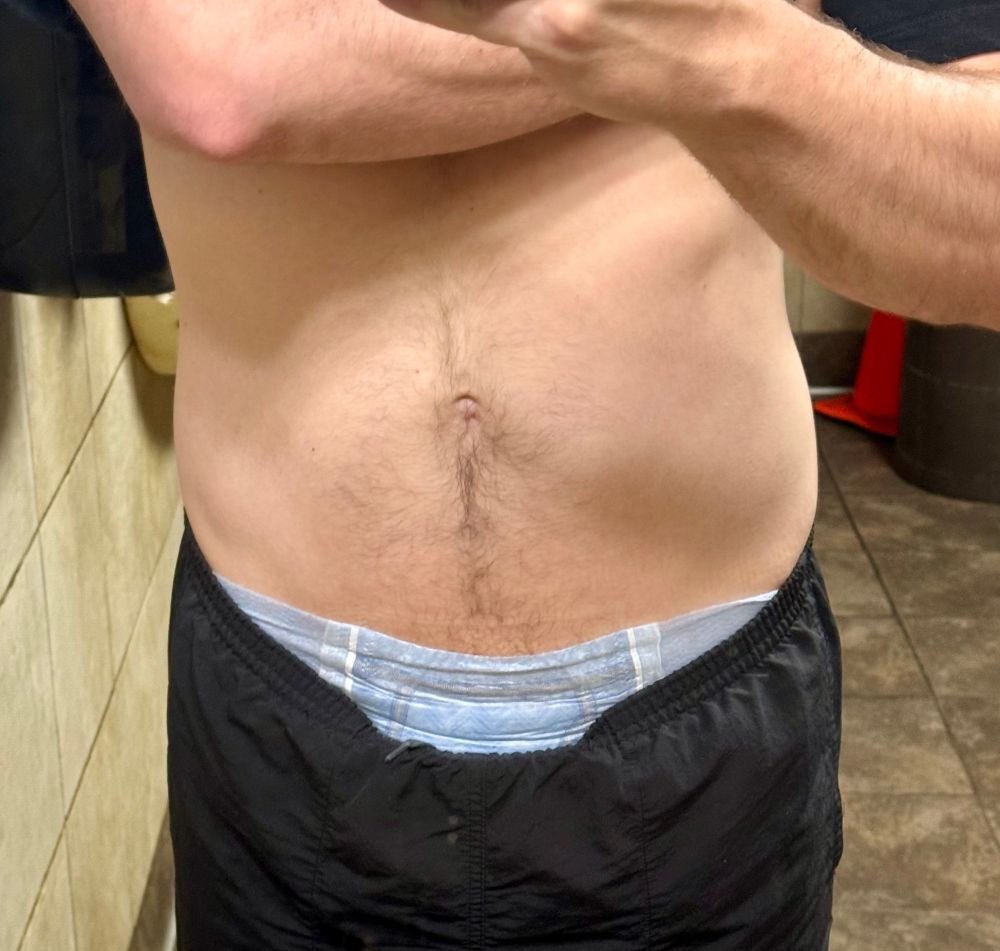 A mirror selfie in a public bathroom with short pulled up and goodnites pull-up visible above the waistband of my shorts