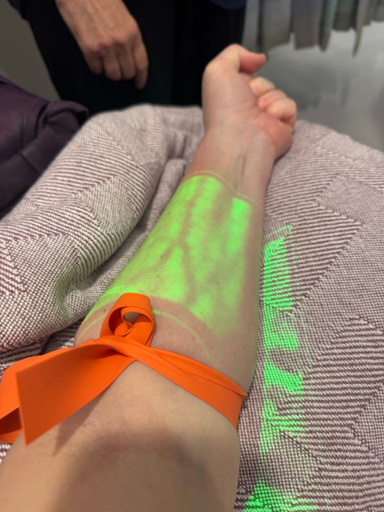 My nurse used a “vein-finder”—similar to a stud finder but for veins—on my arm.