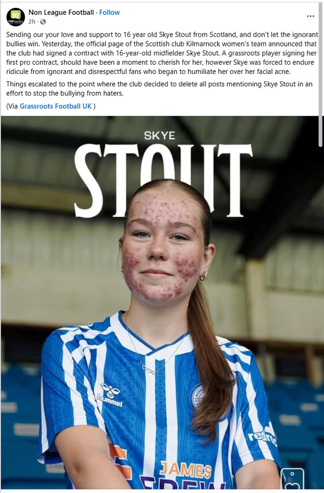 Screenshot of a Facebook post by Non League Football Sending our your love and support to 16 year old Skye Stout from Scotland, and don't let the ignorant bullies win. Yesterday, the official page of the Scottish club Kilmarnock women's team announced that the club had signed a contract with 16-year-old midfielder Skye Stout. A grassroots player signing her first pro contract, should have been a moment to cherish for her, however Skye was forced to endure ridicule from ignorant and disrespectful fans who began to humiliate her over her facial acne. Things escalated to the point where the club decided to delete all posts mentioning Skye Stout in an effort to stop the bullying from haters. (Via Grassroots Football UK )