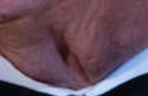 Another close up shot of Donald Trump's neck vagina, created by a combination of the tightness of his shirt collar combined with his saggy old neck skin.