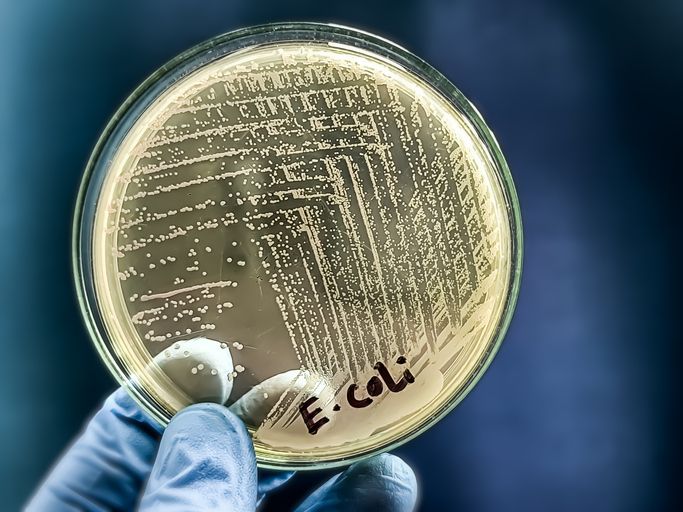 Agar plate covered in E. coli.