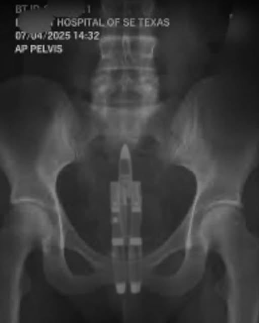 It doesn't even vibrate.