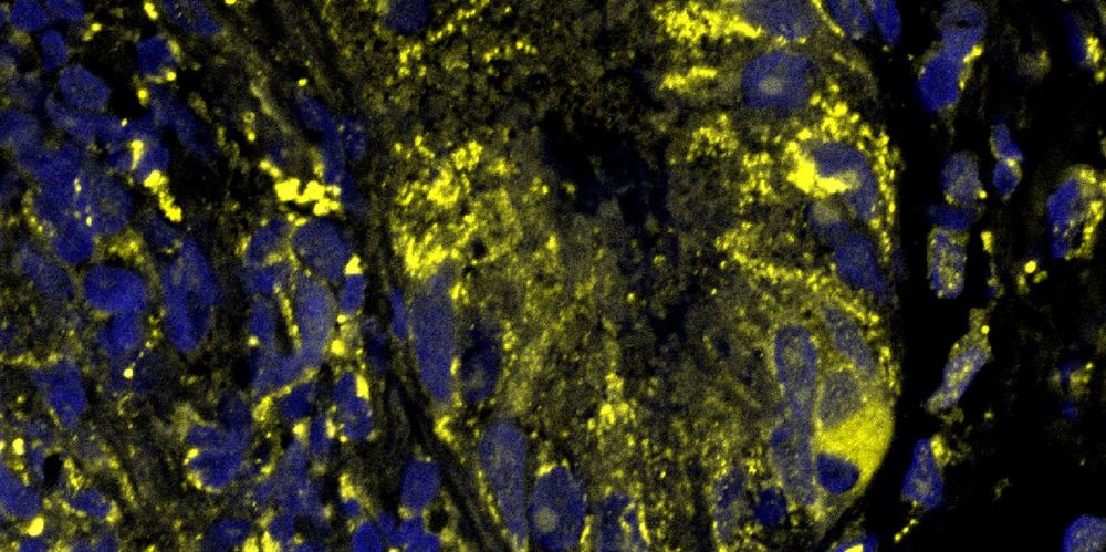 Ein Bild mit einem farbigen, abstrakten Hintergrund in Gelb und Blau.