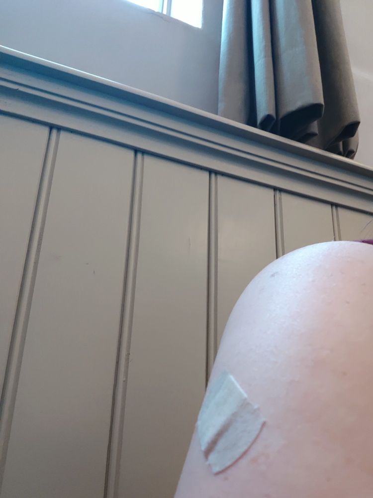 De bovenarm van een witte vrouw met een pleister. De achtergrond is een beige lambrisering met daarboven een raamkozijn met een beige gordijn.