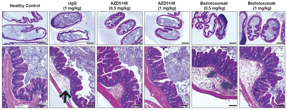 Hematoxylin and eosin-stained ceca of mice prophylactically administered antibodies, then infected with the TcdB3-encoding strain M68. Columns left-to right are: healthy control, isotype IgG control, 0.5 mg/kg AZD5148, 1 mg/kg AZD5148, 0.5 mg/kg bezlotoxumab, and 1 mg/kg bezlotoxumab. The healthy tissue has nicely formed crypts, not much space between the mucosa and the seromuscular layer, indicating that there is no edema. The control IgG group has significant expansion of the submucosa and inflammatory cells in this compartment as well as an expansion of gut-associated lymphoid tissue. The 0.5 mg/kg AZD5148 cecum images have less submucosal edema and inflammatory infiltrates compared to the control IgG group, but the 1 mg/kg AZD5148 images are near healthy. In contrast, both 0.5 and 1 mg/kg groups of bezlotoxumab have significant amounts of edema and inflammatory infiltrates.