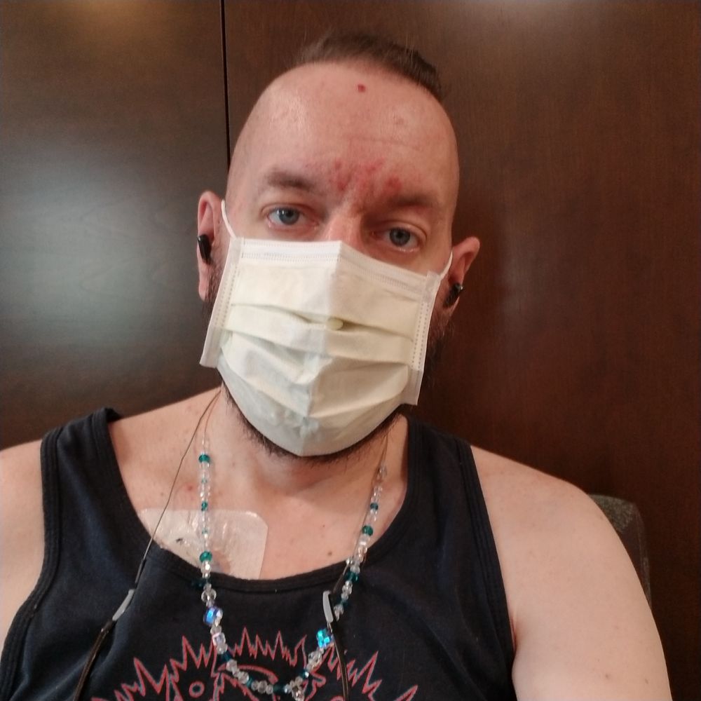 Me, a white middle aged man wearing a disposable face mask. A portion of my medical port implant covering is showing from behind my tank top shirt. 