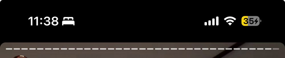 screenshot of an instagram story with too many story tabs to count. the tabs are so small they’re almost dots.
