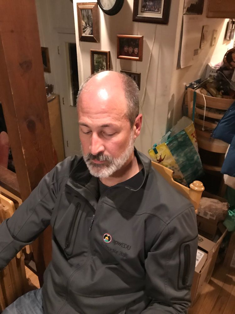 Me with an extremely bald head