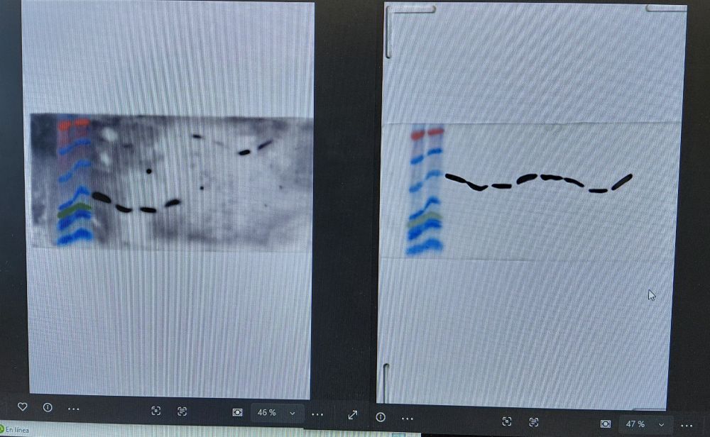 Western Blot de Uniportador Mitocondrial de Calcio. 

1a foto de izquierda a derecha:
-2 marcadores de peso molecular.
-4 células control
-4 células MCU knoqueadas (no tiene que salir banda)

2da foto: control mediante house keeping mediante Anticuerpo primario Beta-actina-mouse.