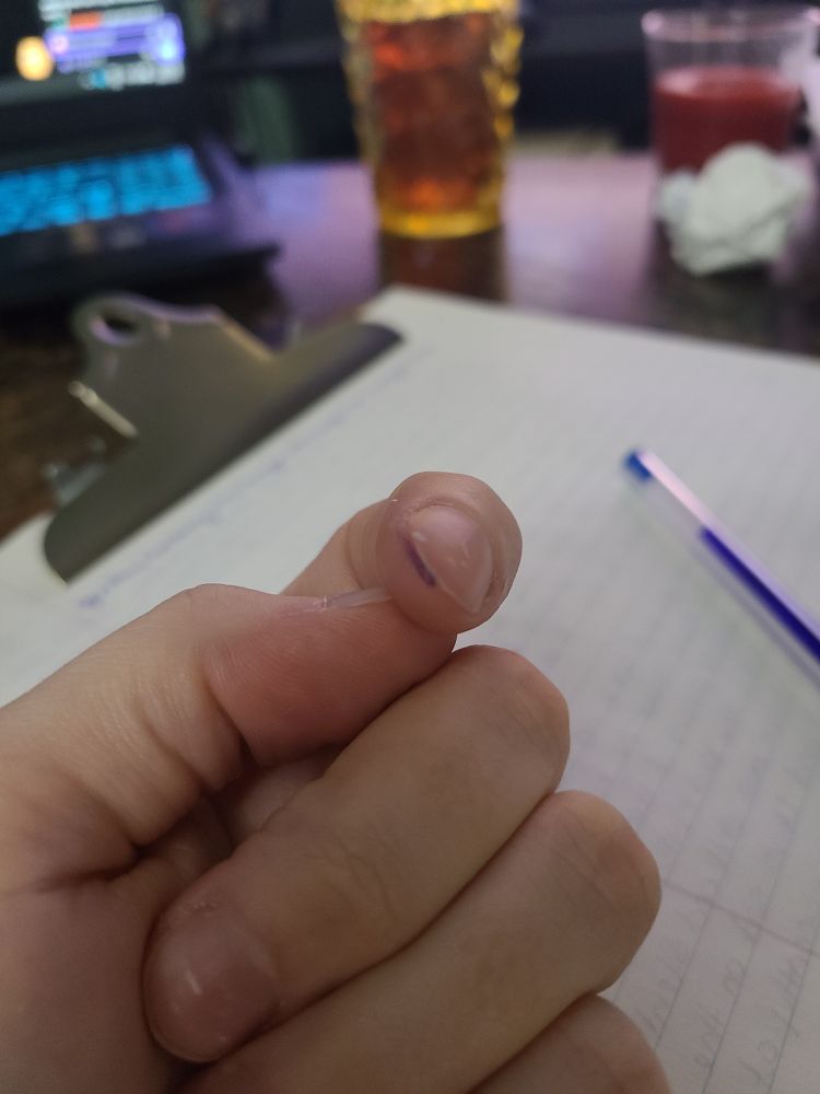 a close-up of a finger with a blue pen streak by the fingernail