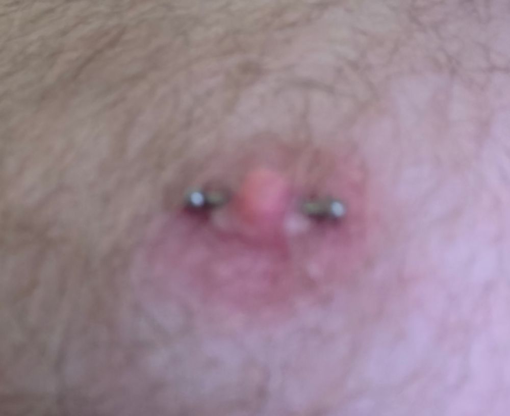 Nipple piercing 