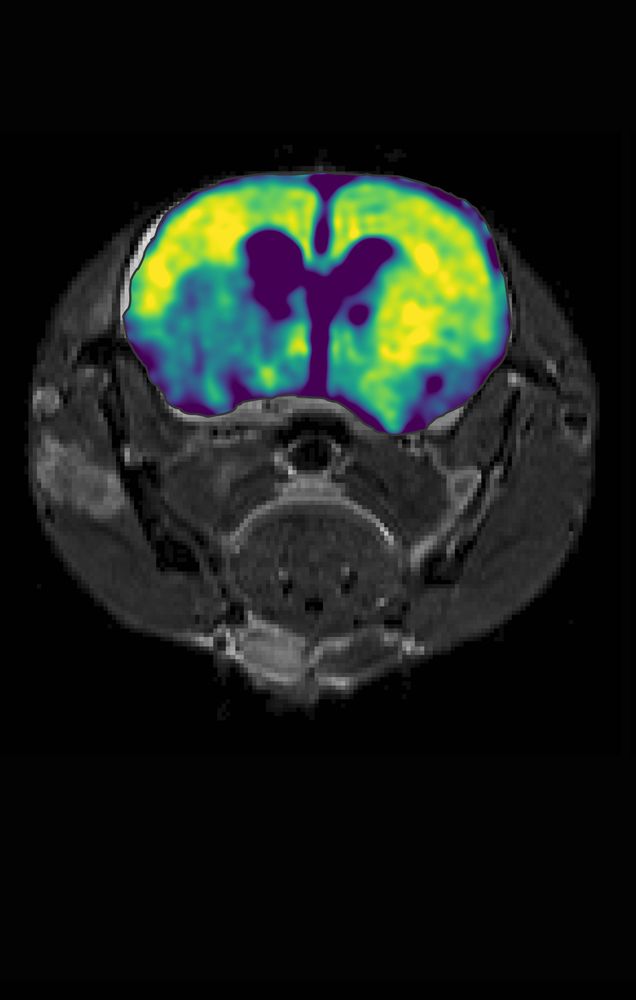 2DG CESL MRI in rat brain after stroke.