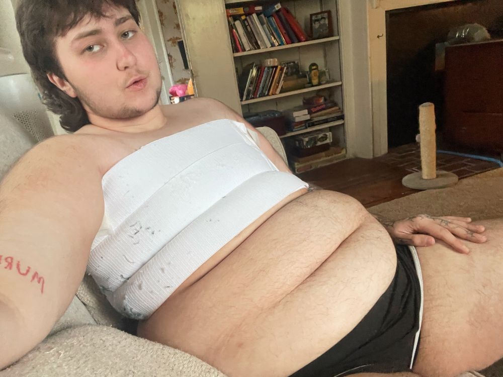 Danny is sitting on the couch with just a medical binder and black shorts on. his hairy belly is out and he’s looking down at the camera. 
