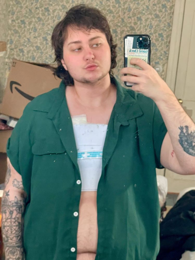danny with his chest bandage/binder peeking out under an unbuttoned green shirt. You can see his hairy belly. It is a mirror selfie. 