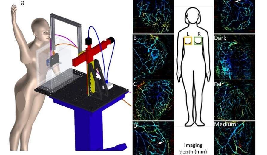 A composite scientific illustration. On the left, a 3D rendering shows a mannequin interacting with a robotic imaging system that scans tissue through a transparent panel. On the right, a diagram of a human torso is surrounded by several color-coded imaging results of subdermal structures, with labels indicating varying skin tones (“Dark,” “Fair,” and “Medium”) and imaging depths. Panels B, C, and D show intricate vascular or tissue networks captured at different depths beneath the skin.