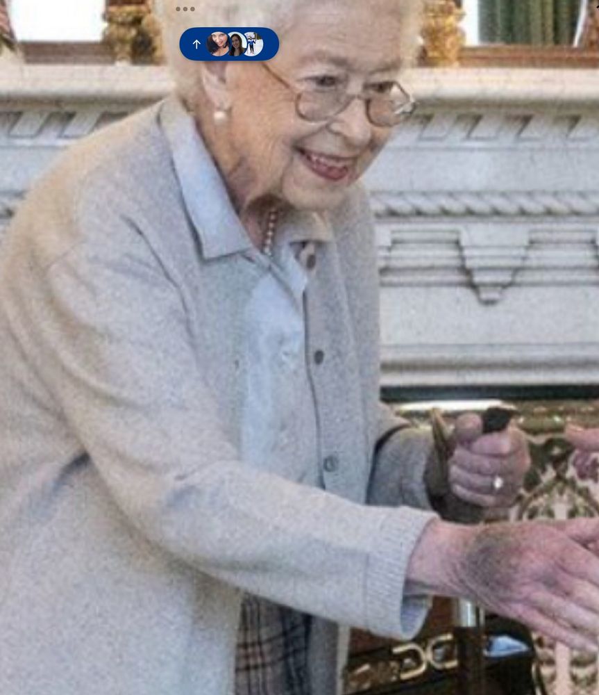Queen Elizabeth's hand with big bruise like Trump.
