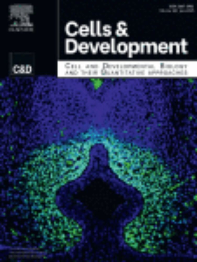 Developmental programming by maternal obesity alters offspring lifespan and immune responses in a diet- and sex-specific manner
