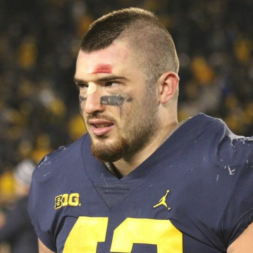 A fullback with a sensible faux hawk and some bloodied gauze over his left eye. 