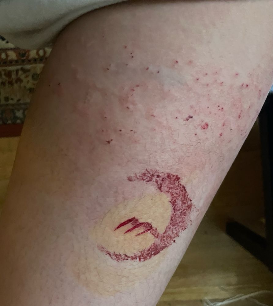 Close up of Noor’s thigh covered in puncture wounds from their cilice and three paralleled and angled cuts open like mouths, surrounded by a crescent moon of dried blood 