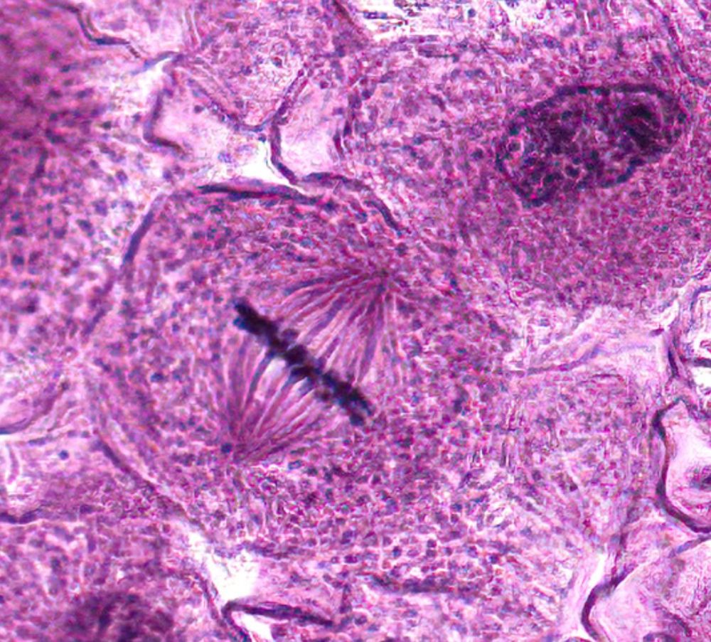 A photograph of a cell undergoing metaphase of mitosis. The chromosomes are aligned along the midline (metaphase plate) with mitotic spindles (like fine hairs) running to the two poles of the cell.