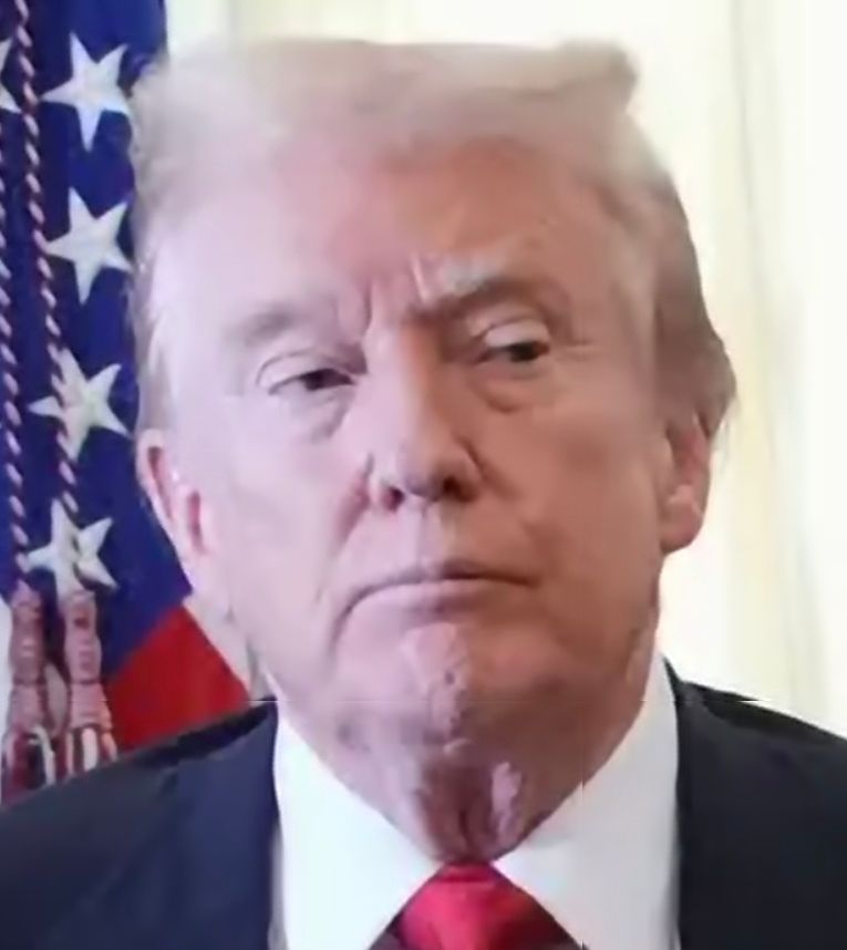 A close-up of Trump’s face showing pronounced facial drooping around the mouth. 