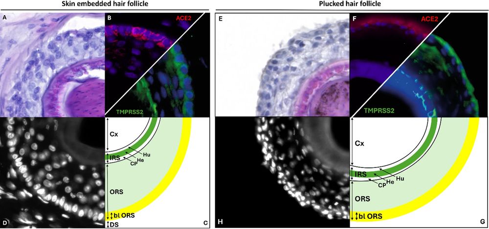 Schematische Darstellung der ACE2- und TMPRSS2-Färbung von in Haut eingebetteten und gezupften humanen Haarfollikeln. Schematische Darstellung der in Haut eingebetteten und gezupften humanen Haarfollikel. Histologische HE-Färbung ( A , E ), Einzelkern-DAPI-Färbung (weiß, D , H ) und ACE2-, TMPRSS2-Färbung (grün, B , F ). In der Abbildung ( C , G ) zeigt die äußere Wurzelscheide (ORS) nach außen eine einzelne Basalschicht (bl ORS). Die überlappende Expression von ACE2 (rot) und TMPRSS2 (grün) innerhalb der Basalschicht (bl) der ORS ist gelb dargestellt und entspricht der unter dem Fluoreszenzmikroskop beobachteten Farbüberlappung. Neben der Rinde (Cx) besteht die innere Wurzelscheide (IRS) aus der Begleitschicht (CP), der Henle-Schicht (He) und der Huxley-Schicht (Hu). Beachten Sie, dass die dermale Scheide (DS), in der sich Kapillaren und Nervenendigungen befinden, sowie die Dermis im ausgerissenen Haarfollikel fehlen.