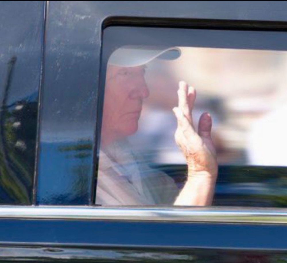 Picture of a droopy-eyed, vacantly staring Donald Trump in the back of his limo. 