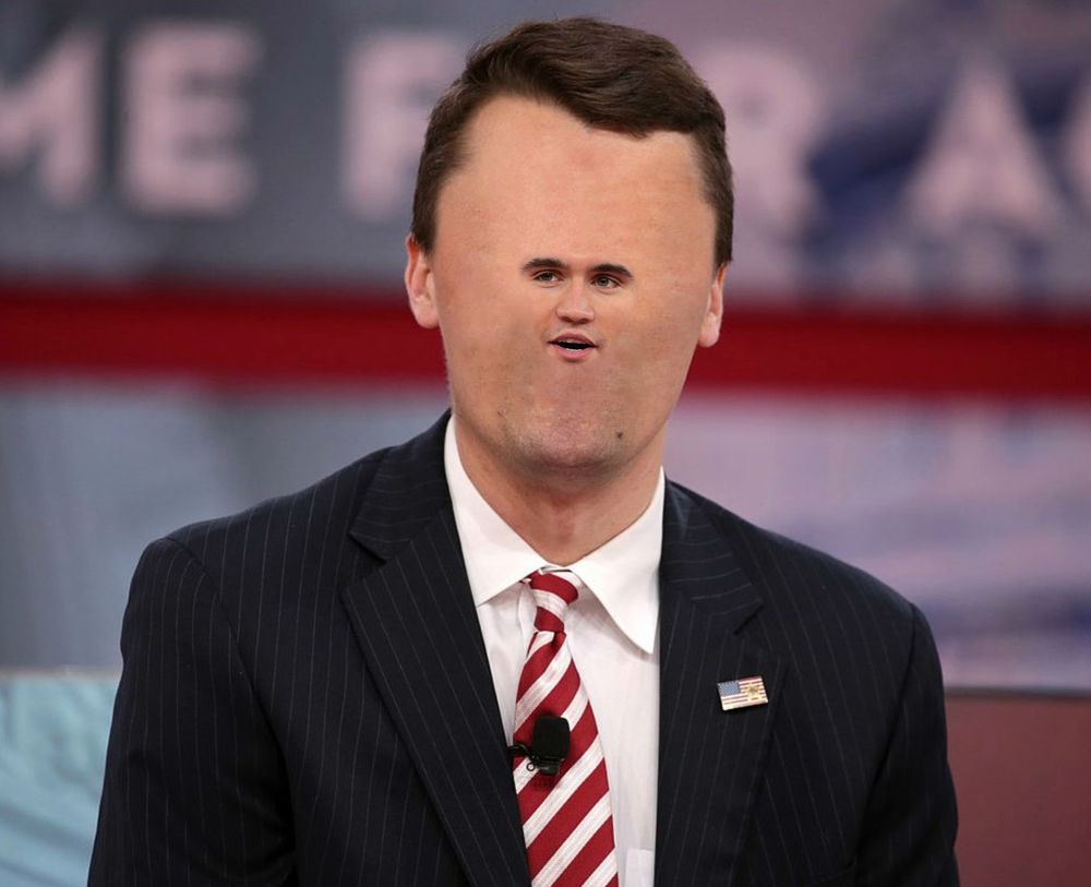 picture of charlie kirk altered with kirk slider to make his face even smaller. https://blovish.github.io/kirkslider/