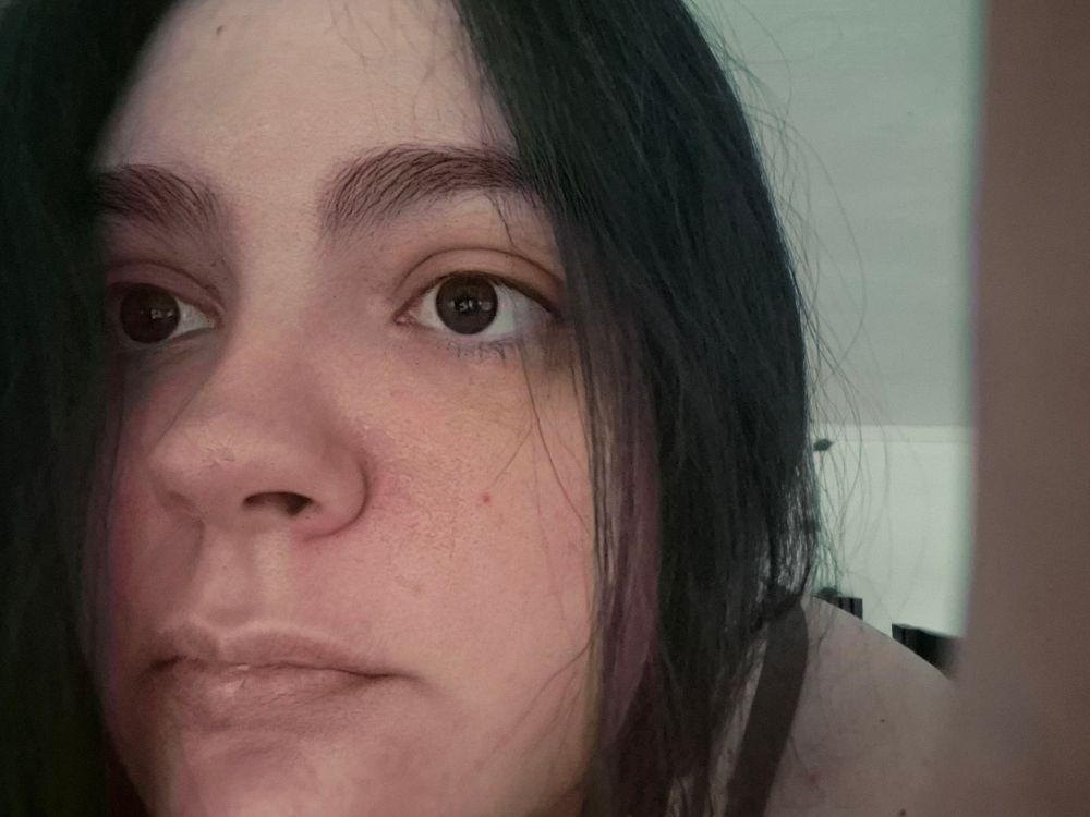 My face looking a bit worried and rough lol