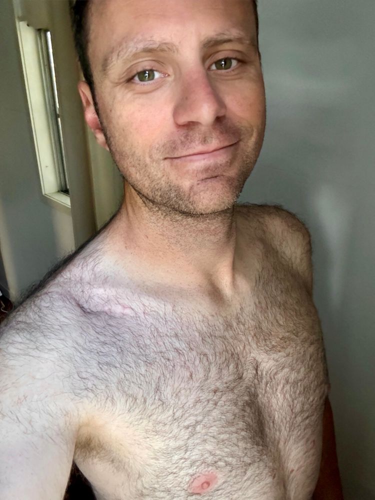 me and my hairy chest